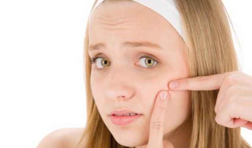 Rimedi contro i brufoli: come fare per eliminare acne bolle punti neri