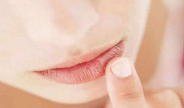 Labbra secche e screpolate: cause e rimedi bruciore dolore, taglietti