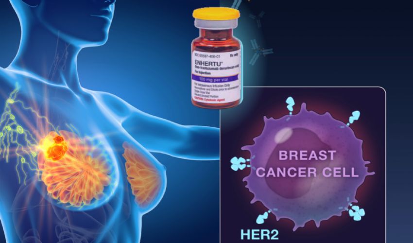 Carcinomi della mammella femminile: c’è un’alternativa alla chemio