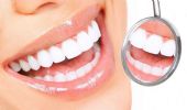 Sbiancamento denti 2021: costo, rimedi naturali e led dal dentista