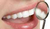 Sbiancamento denti 2021: quanto costa kit, dal dentista e fai da te