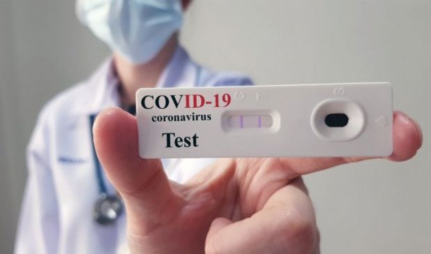 Tamponi test sierologici Covid fino a che punto servono per scoprirlo?